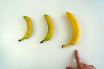 Different size and shape of Banana compare, penis Size compare concept. Men's intimate plastic surgery - obrazy, fototapety, plakaty