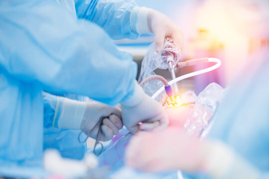 Modern laparoscopic equipment, doctor surgery working, sunlight. Operation process on abdominal, blue light