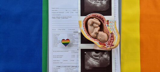 Embryo ultrasound and surrogacy for same-sex marriages