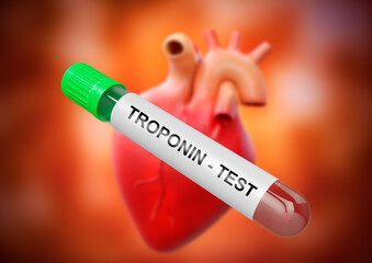 Obraz premium Troponin is the main biochemical marker used to confirm a heart attack. Blood sample in tube