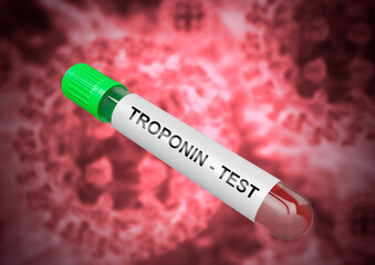 Troponin is the main biochemical marker used to confirm a heart attack. Blood sample in tube