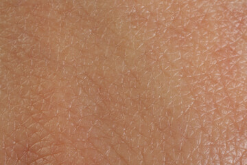Texture of healthy skin as background, macro view