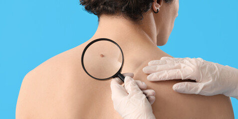 Doctor examining mole of young man on light blue background. Concept of skin cancer