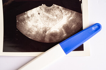 Pregnancy test with ultrasound scan of baby uterus, contraception health and medicine.