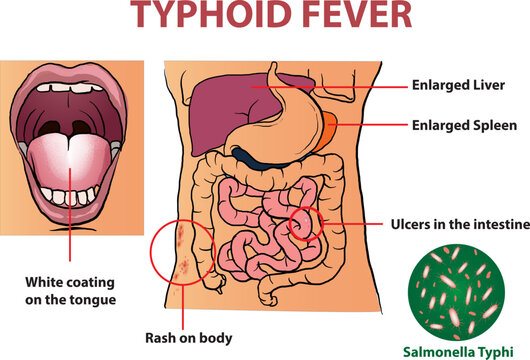 illustration of canyon diagram in hand drawn style