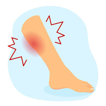 leg cramps