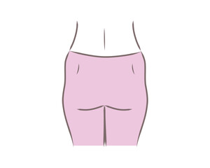 太いお尻・ピーマン尻の女性の下半身のイラスト
