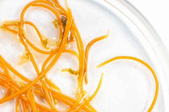 Backgrounds of Characteristics of Acanthocephalans (Thorny-headed worms, or spiny-headed worms) under the microscope for education in laboratory.