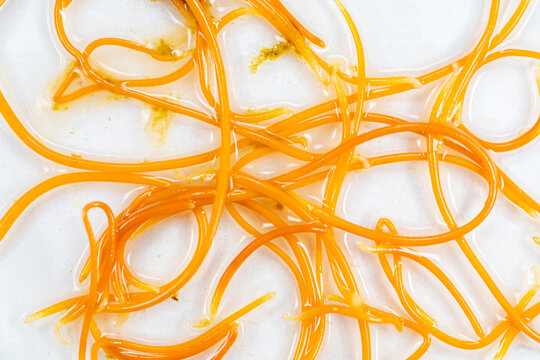 Backgrounds of Characteristics of Acanthocephalans (Thorny-headed worms, or spiny-headed worms) under the microscope for education in laboratory.