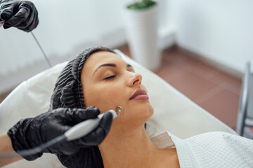 Beautiful caucasian young woman is doing a mole removal procedure in a modern beauty cosmetic...