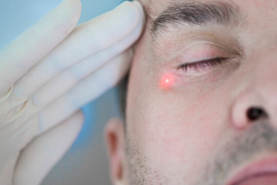 Man Receiving Laser Treatment on Face
