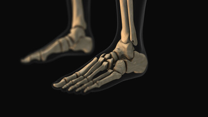 Medical animation of the mid foot pain