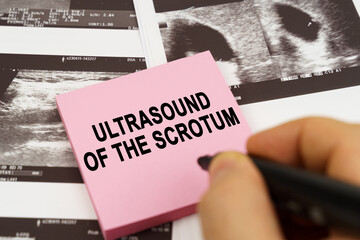On the ultrasound pictures there are stickers that say - Ultrasound of the scrotum