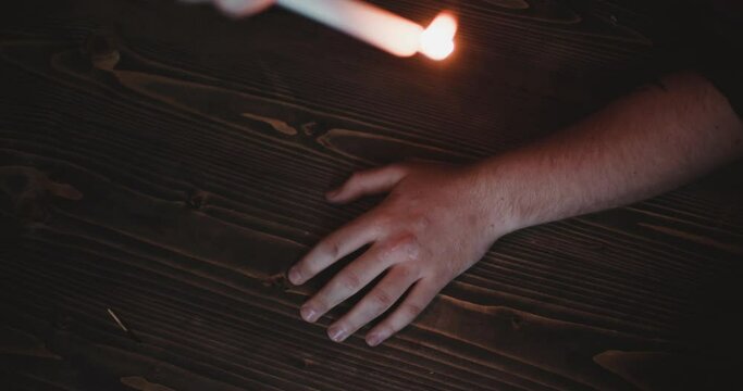 Hot Liquid Wax Drips Onto A Man's Hand. 