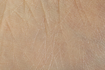 Texture of dry skin as background, macro view