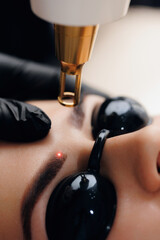 Laser removal of tattoo permanent makeup eyebrow of young woman in salon