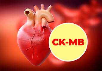 CK-MB is an enzyme and cardiac biochemical marker whose elevation may be indicative of acute myocardial infarction