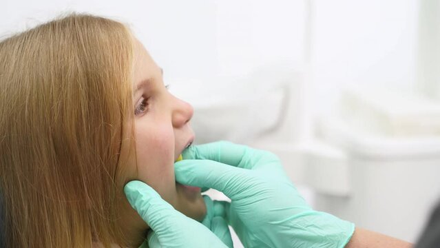 Dentist's hands preparing girl for teeth examination in modern dental office. Professional stomatologist puts mouth prop into a child mouth. Using bite block in the pediatric dentistry. Close-up.