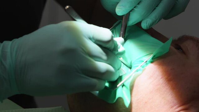 Close-up shot of patient's face with cofferdam. Hands of dentist treat teeth patient using rubber dam. Patient gets dental treatment at the modern dental office. Stomatologist treats caries decay.
