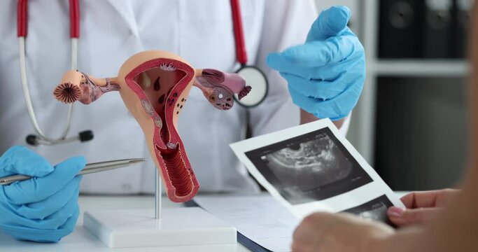 Gynecologist demonstrates model of female reproductive system to young woman in clinic closeup. Ultrasound of uterus concept