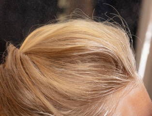 White snowflakes on the blonde's hair. Macro
