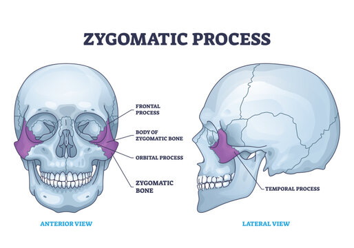 Zygomatic process as human cheek bone skeleton anatomy outline diagram, transparent background.Labeled educational cheekbone location and skull parts structure illustration.