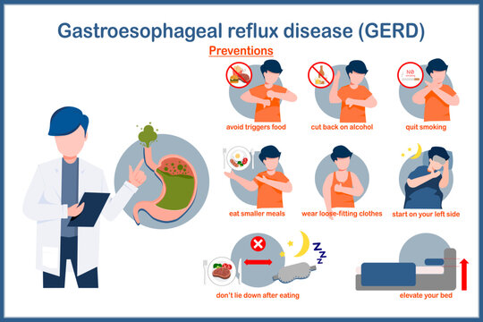 Medical vector illustration in flat style.preventions of GERD.avoid trigger food,limit alcohol,quit smoking,eat small meals,wear loose clothing,don’t lie down after eating.isolate on white background.