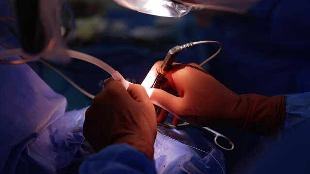 Neurosurgeon wearing brown latex gloves uses surgical tools. Microsurgery close up in modern hospital.