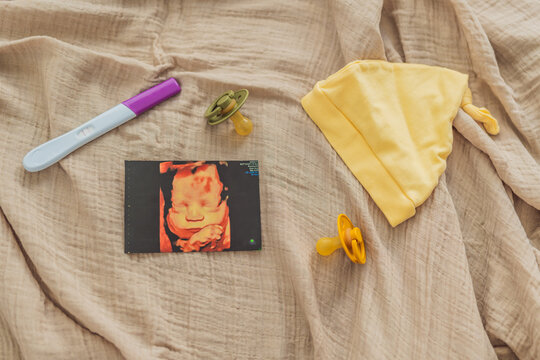 A composition of essential pregnancy attributes: a positive pregnancy test, ultrasound image, tiny pacifier, and a soft baby's cap, embodying the journey to motherhood