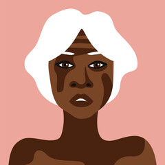 Elderly African American woman with vitiligo in minimalistic style vector
