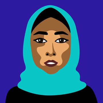Muslim woman in headscarf with skin disease vitiligo in minimalistic style vector image