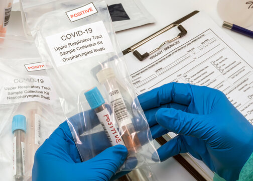 Nurse comparing positive covid-19 test results of infected persons, Conceptual image