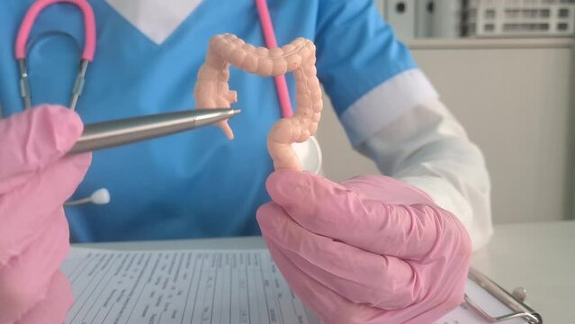 Doctor holding a human colon anatomy model. Colon diseases and treatment