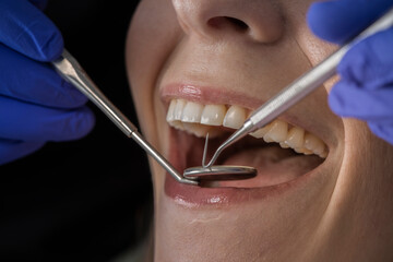 Teeth Cleaning at a Dentist - 707846169