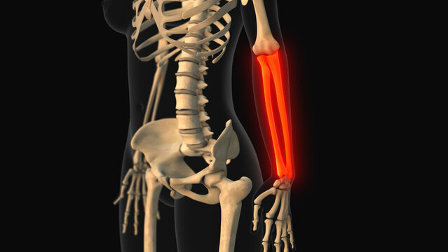 Medical animation of the ulna radius bone pain