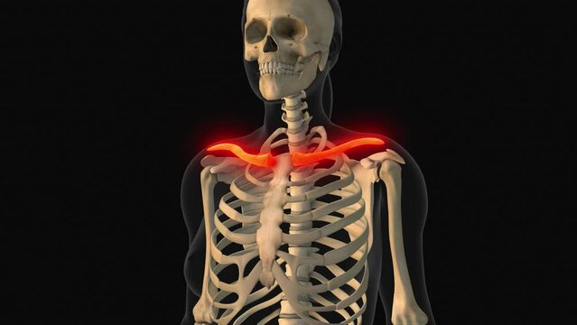 Medical animation of the clavicle bone pain