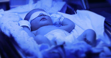 Newborn baby boy under phototherapy lamp. getting treated for jaundice