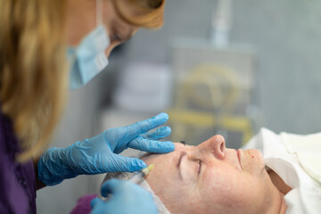 The beautician inserts a needle into the client's forehead to introduce the product under the skin.