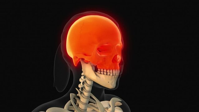 Medical animation of the skull bone pain