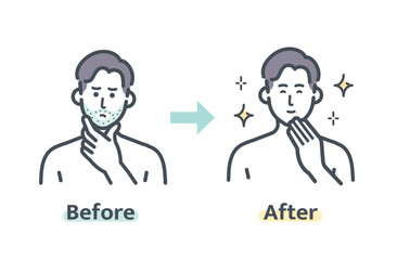 ヒゲ脱毛のビフォーアフター