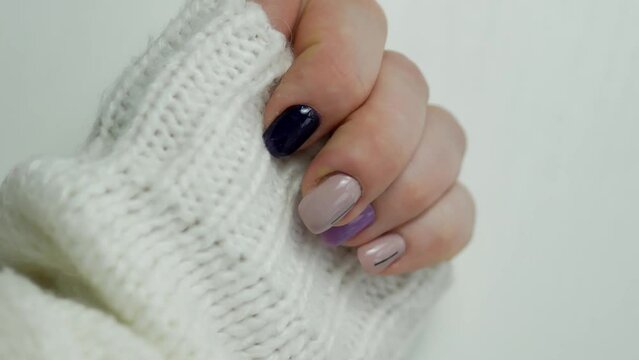 The finger is swollen from inflammation due to infection caused by a torn nail, the finger with pus next to the nail is paronychia.