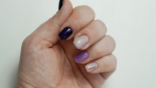 Paronychia is an inflammation of the periarticular roller. A purulent pad near the nail on a woman's hand. Treatment of dermatological inflammations.