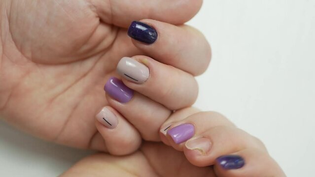 Women's hands with a beautiful manicure with a swollen finger from inflammation due to infection and a fungal nail, a finger with pus next to the nail of paronychia.