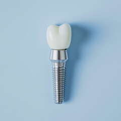 Zahn Implantat Nahaufnahme, ai generativ