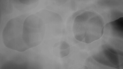 black and white background