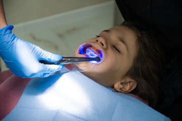 A dentist puts braces on the teeth of a young girl child. Illumination of a tooth using a...