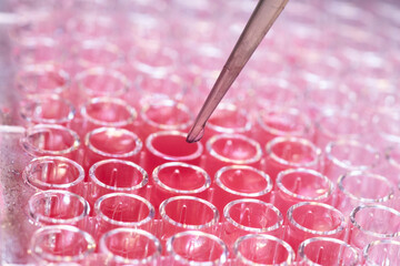 geneticist working with microplate for cells analysis in the genetic lab. Researcher working with samples of tissue culture in microplate in the bioengineering laboratory