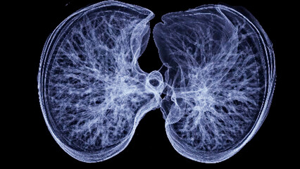 CT Chest or Lung 3d rendering image  showing Trachea and lung in respiratory system..