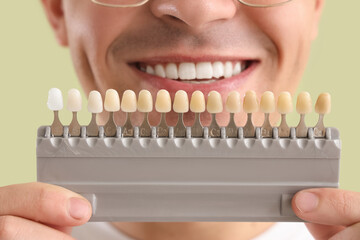 Handsome young man with teeth color samples on green background. Dental care concept