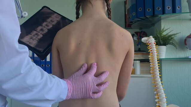 Doctor surgeon examining back of child patient and x-ray of spine. Formation of healthy spine in child